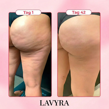 Velura Anti-Cellulite